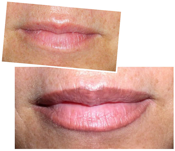 Permanent lips 3